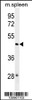 Western blot analysis in mouse spleen tissue lysates (35ug/lane) .