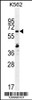 Western blot analysis in K562 cell line lysates (35ug/lane) .