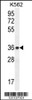 Western blot analysis in K562 cell line lysates (35ug/lane) .