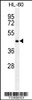 Western blot analysis in HL-60 cell line lysates (35ug/lane) .