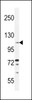 Western blot analysis in ZR-75-1 cell line lysates (35ug/lane) .