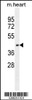 Western blot analysis in mouse heart tissue lysates (35ug/lane) .