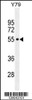 Western blot analysis in Y79 cell line lysates (35ug/lane) .