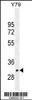 Western blot analysis in Y79 cell line lysates (35ug/lane) .