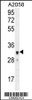 Western blot analysis in A2058 cell line lysates (35ug/lane) .