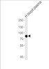 Western blot analysis of lysates from human blood plasma tissue (from left to right) , using LRRC45 Antibody .AP11368b was diluted at 1:1000 at each lane.