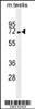 Western blot analysis in mouse testis tissue lysates (35ug/lane) .