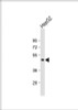 Western Blot at 1:1000 dilution + HepG2 whole cell lysate Lysates/proteins at 20 ug per lane.