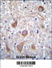 PTCHD1 Antibody immunohistochemistry analysis in formalin fixed and paraffin embedded human brain tissue followed by peroxidase conjugation of the secondary antibody and DAB staining.