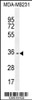 Western blot analysis in MDA-MB231 cell line lysates (35ug/lane) .