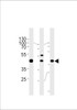 Western blot analysis in A549, K562, MCF-7 cell line lysates (35ug/lane) .This demonstrates the GTF2H2C antibody detected the GTF2H2C protein (arrow) .