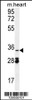 Western blot analysis in mouse heart tissue lysates (35ug/lane) .