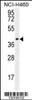 Western blot analysis in NCI-H460 cell line lysates (35ug/lane) .