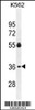 Western blot analysis in K562 cell line lysates (35ug/lane) .