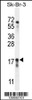 Western blot analysis in SK-BR-3 cell line lysates (35ug/lane) .