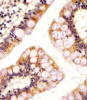 Antibody staining RSBN1 in human colon tissue sections by Immunohistochemistry (IHC-P - paraformaldehyde-fixed, paraffin-embedded sections) .