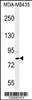 Western blot analysis in MDA-MB435 cell line lysates (35ug/lane) .