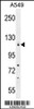 Western blot analysis in A549 cell line lysates (35ug/lane) .