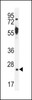 Western blot analysis in mouse kidney tissue lysates (35ug/lane) .