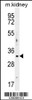 Western blot analysis in mouse kidney tissue lysates (35ug/lane) .