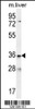 Western blot analysis in mouse liver tissue lysates (35ug/lane) .