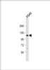 Western Blot at 1:1000 dilution + A549 whole cell lysate Lysates/proteins at 20 ug per lane.