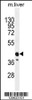 Western blot analysis in mouse liver tissue lysates (35ug/lane) .