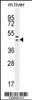 Western blot analysis in mouse liver tissue lysates (35ug/lane) .