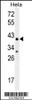 Western blot analysis in Hela cell line lysates (35ug/lane) .