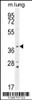 Western blot analysis in mouse lung tissue lysates (35ug/lane) .