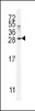 Western blot analysis in MDA-MB231 cell line lysates (35ug/lane) .