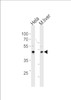 Western blot analysis in Hela cell line and mouse liver tissue lysates (35ug/lane) .This demonstrates the TBX6 antibody detected the TBX6 protein (arrow) .