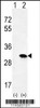 Western blot analysis of HRAS using rabbit polyclonal HRAS Antibody using 293 cell lysates (2 ug/lane) either nontransfected (Lane 1) or transiently transfected (Lane 2) with the HRAS gene.