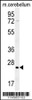 Western blot analysis in mouse cerebellum tissue lysates (35ug/lane) .