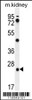 Western blot analysis in mouse kidney tissue lysates (35ug/lane) .