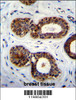 QTRTD1 Antibody immunohistochemistry analysis in formalin fixed and paraffin embedded human breast tissue followed by peroxidase conjugation of the secondary antibody and DAB staining.