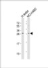 Western Blot at 1:500-1:1000 dilution Lane 1: human testis lysate Lane 2: NCI-H460 whole cell lysate Lysates/proteins at 20 ug per lane.