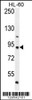 Western blot analysis in HL-60 cell line lysates (35ug/lane) .