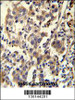 CCDC110 Antibody immunohistochemistry analysis in formalin fixed and paraffin embedded human testis carcinoma followed by peroxidase conjugation of the secondary antibody and DAB staining.