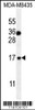 Western blot analysis in MDA-MB435 cell line lysates (35ug/lane) .