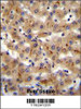 CSAD Antibody immunohistochemistry analysis in formalin fixed and paraffin embedded human liver tissue followed by peroxidase conjugation of the secondary antibody and DAB staining.