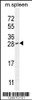 Western blot analysis in mouse spleen tissue lysates (35ug/lane) .