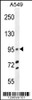 Western blot analysis in A549 cell line lysates (35ug/lane) .