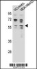 Western blot analysis in NCI-H460, MDA-MB453 cell line lysates (35ug/lane) .