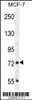 Western blot analysis in MCF-7 cell line lysates (35ug/lane) .