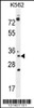 Western blot analysis in K562 cell line lysates (35ug/lane) .