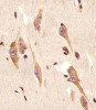 Antibody staining TGFBR2 in human brain sections by Immunohistochemistry (IHC-P - paraformaldehyde-fixed, paraffin-embedded sections) .