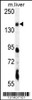 Western blot analysis in mouse liver tissue lysates (35ug/lane) .