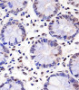 Antibody staining PELP1 in human colon tissue sections by Immunohistochemistry (IHC-P - paraformaldehyde-fixed, paraffin-embedded sections) .