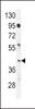 Western blot analysis in mouse spleen tissue lysates (35ug/lane) .